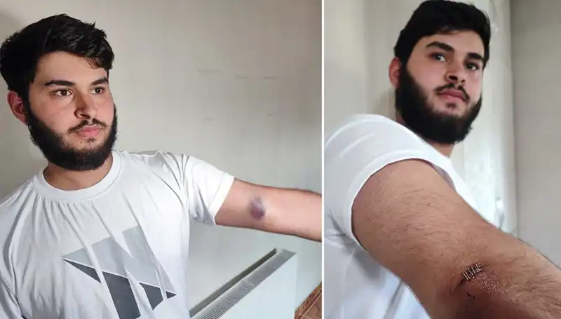 Bahçeye Kaçan Top Mahalleyi Karıştırdı: Conolar Kamyonetle Geldi!